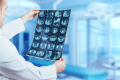 doctor-examine-mri-picture-medical-equipment-medical-1