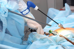 operation-stomach-medical-procedure-treating-patient-with-surgical-intervention-operating-room-1